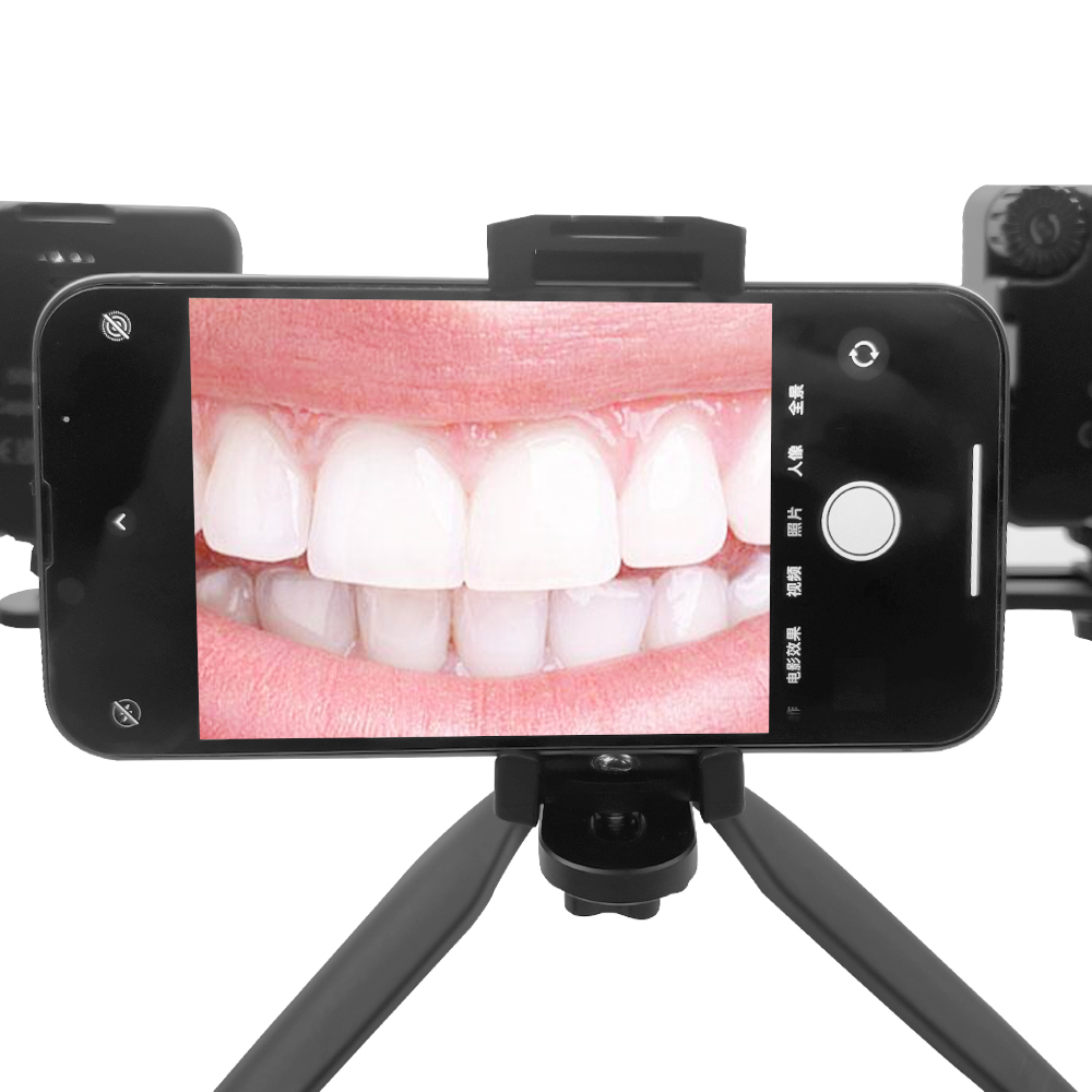Стоматологическая фотография – обзор и цена Photography Mobile Lighting